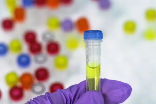 Test Rapide Orientation Diagnostic en Pharmacie TROD